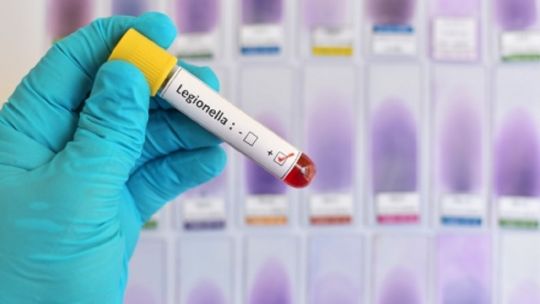 Efecto Legionella: cómo se prepara la región para las nuevas pandemias