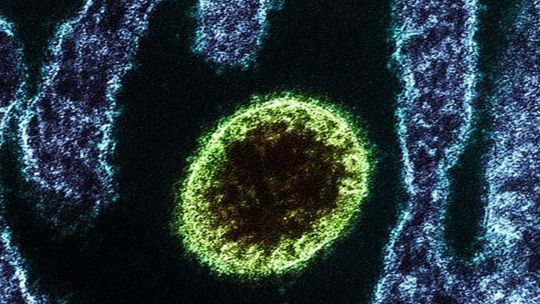 Científicos chinos hallaron 35 infecciones por un nuevo virus animal, bautizado Langya
